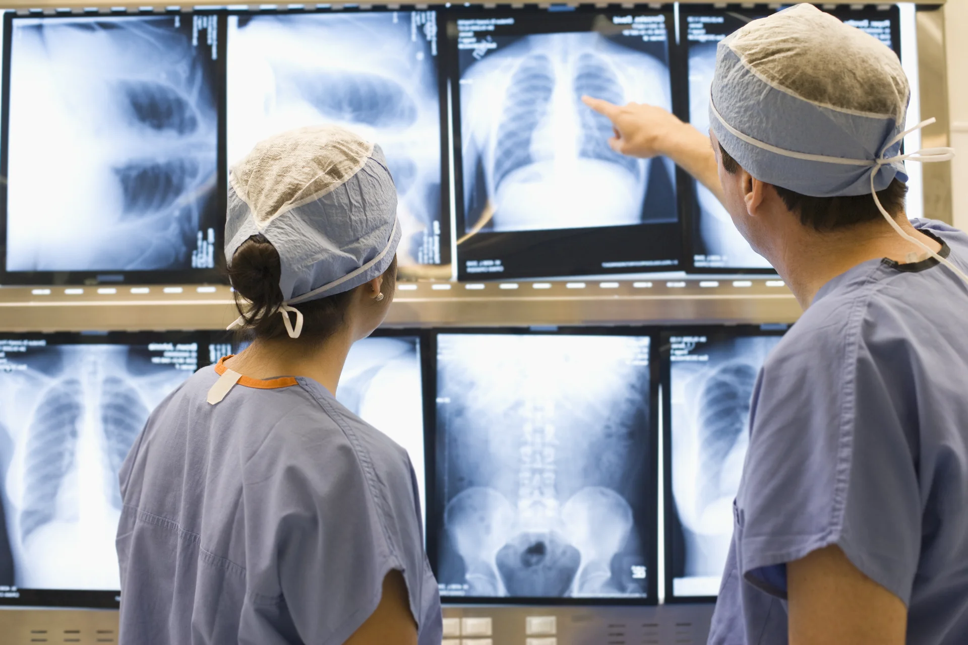 Novo protocolo de tratamento do câncer de pulmão propõe ampliar o acesso à cirurgia torácica assistida por vídeo para pacientes do sistema público de saúde (SUS)