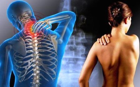Primeira terapia oral de curta duração para esclerose múltipla chega ao SUS